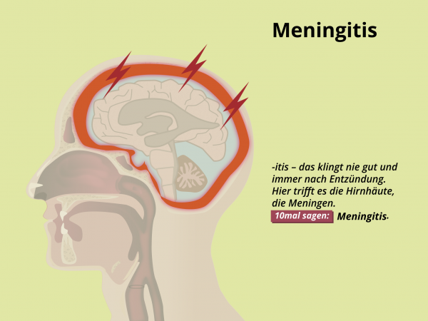 Meningitis