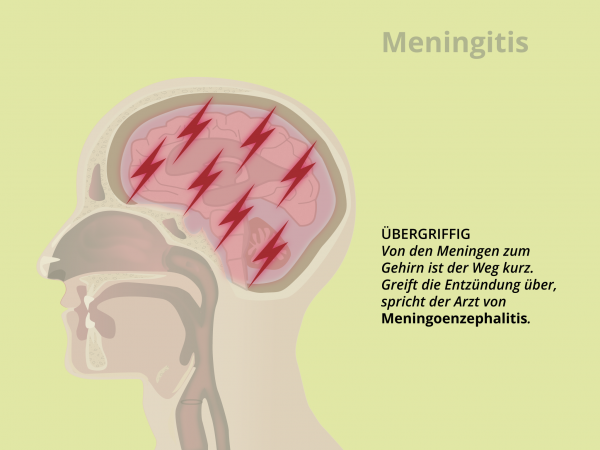 Meningitis / Meningoencephalitis