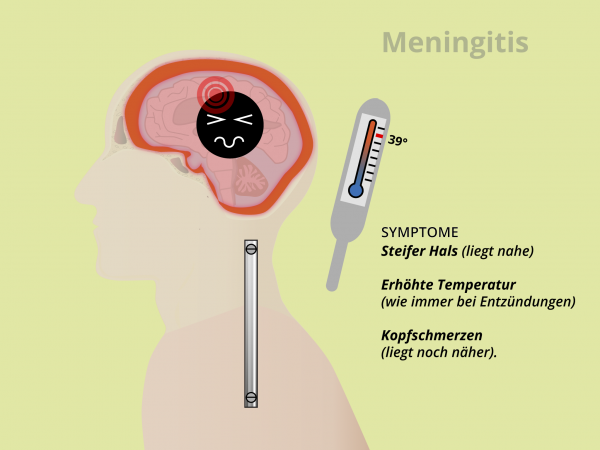 Meningitis / Symptome
