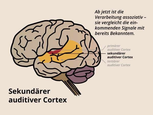 Auditiver Cortex / Sekundärer auditiver Cortex