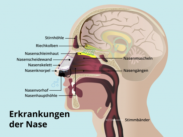 Erkrankungen der Nase