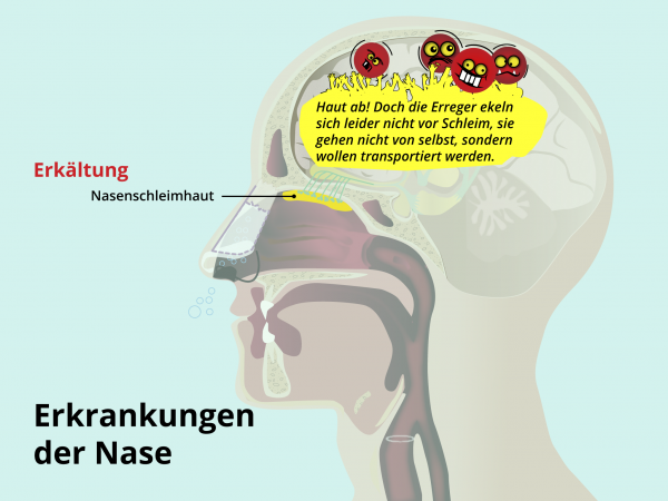Erkrankungen der Nase / Erkältung